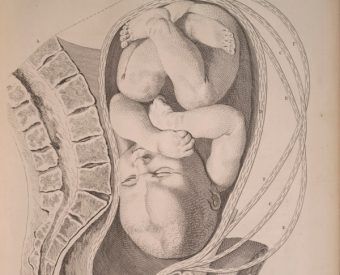 Rysunek z pracy anatomicznej Williama Smelliego.