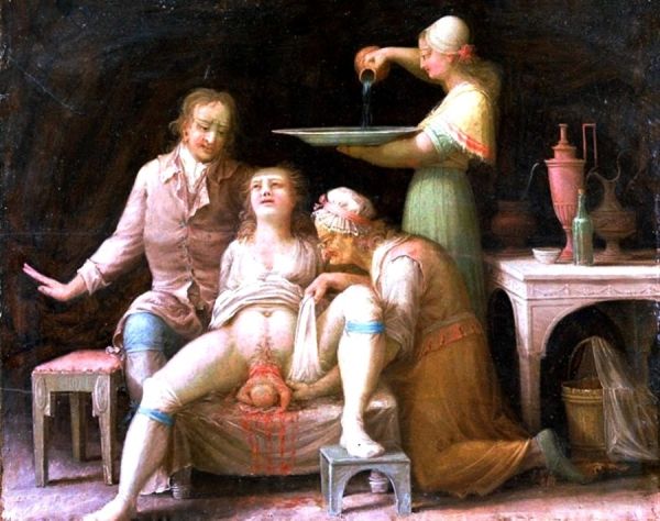 Poród na francuskiej ilustracji z XVIII wieku.